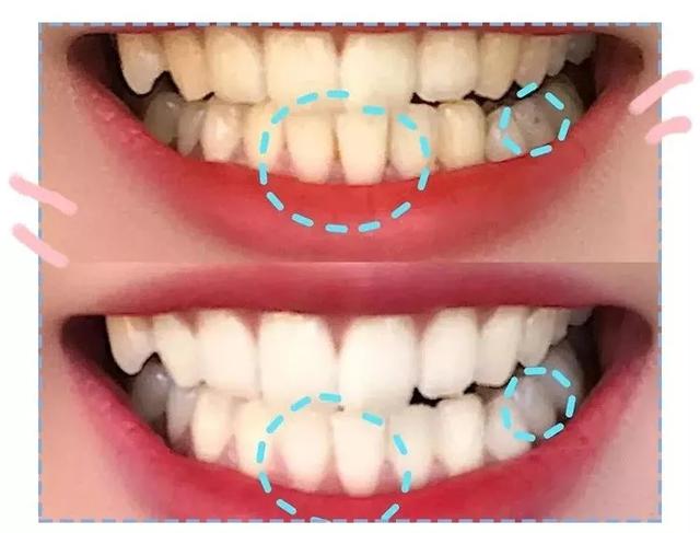消费者表示，售价10英镑的产品能让牙齿在一周内“明显变白”